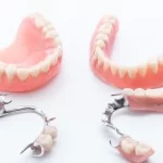 6-types-of-partial-denture-replacement