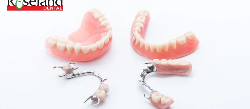 6 Types of Partial Denture Replacement Options.
