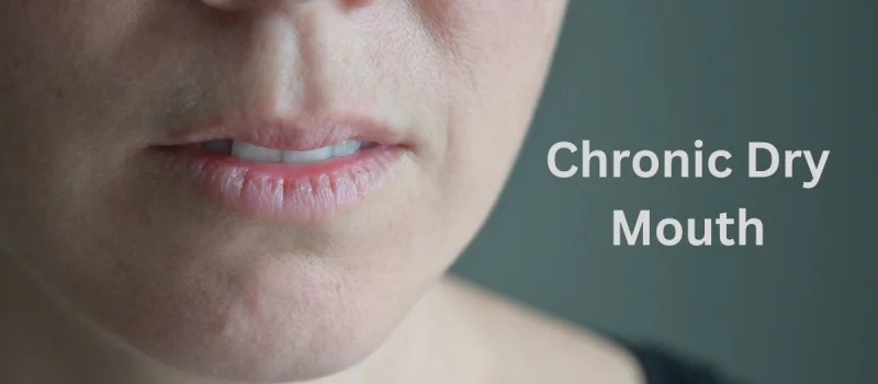 6 Reasons You May Be Experiencing Chronic Dry Mouth