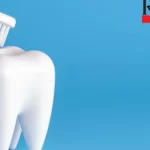 9 Benefits of Dental Bonding