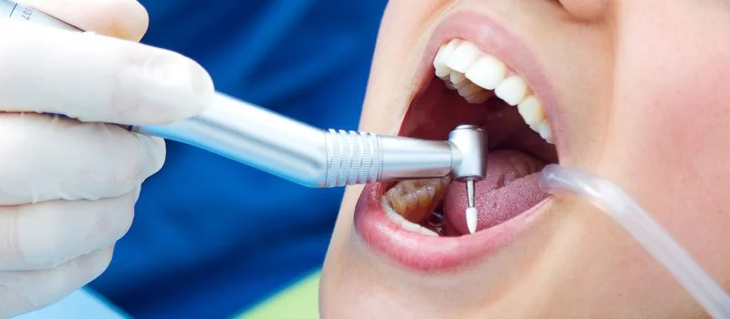 A Comprehensive Guide To Understanding Root Canal