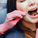 root canal treatment Toronto
