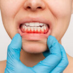 general dentistry Toronto