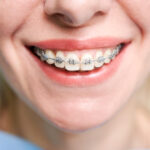 orthodontic treatment Toronto