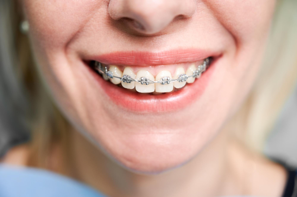 orthodontic treatment Toronto