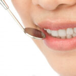 teeth whitening Toronto