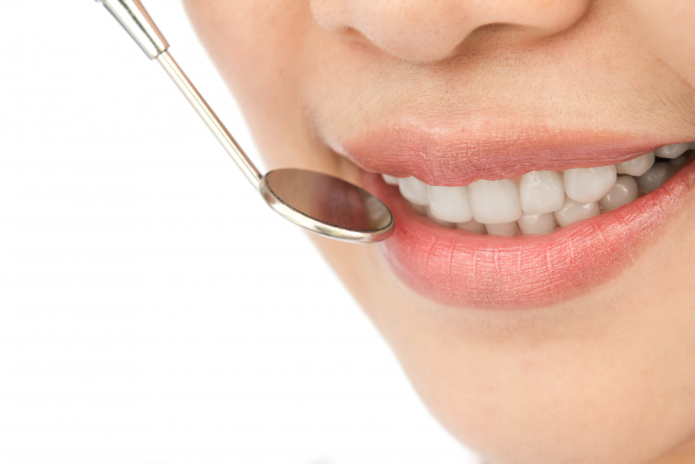 teeth whitening Toronto